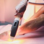 Épilation définitive haute technologie pour homme ou femme à JFG Clinic Gaillard