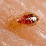 Punaise de lit gorgée de sang observée sur la peau humaine lors d’une infestation traitée en Haute-Savoie par Le Congélo Thermique